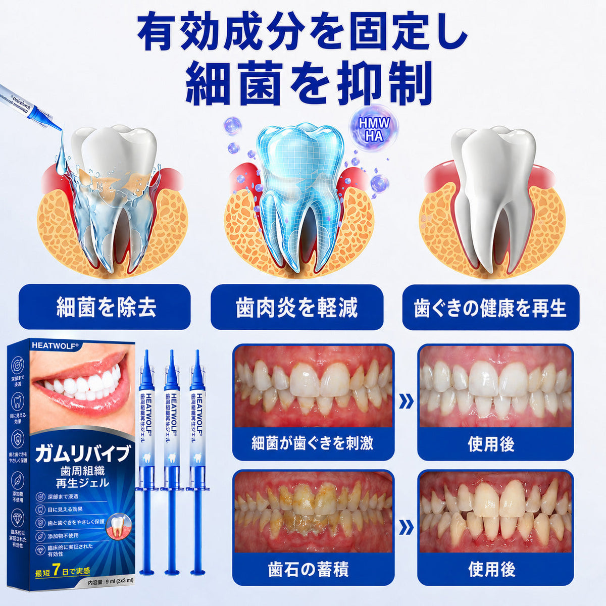 🇯🇵 👨‍⚕️✅🦷 HEATWOLF® GumRevive – 歯周組織修復ジェル 🦷✨2️⃣