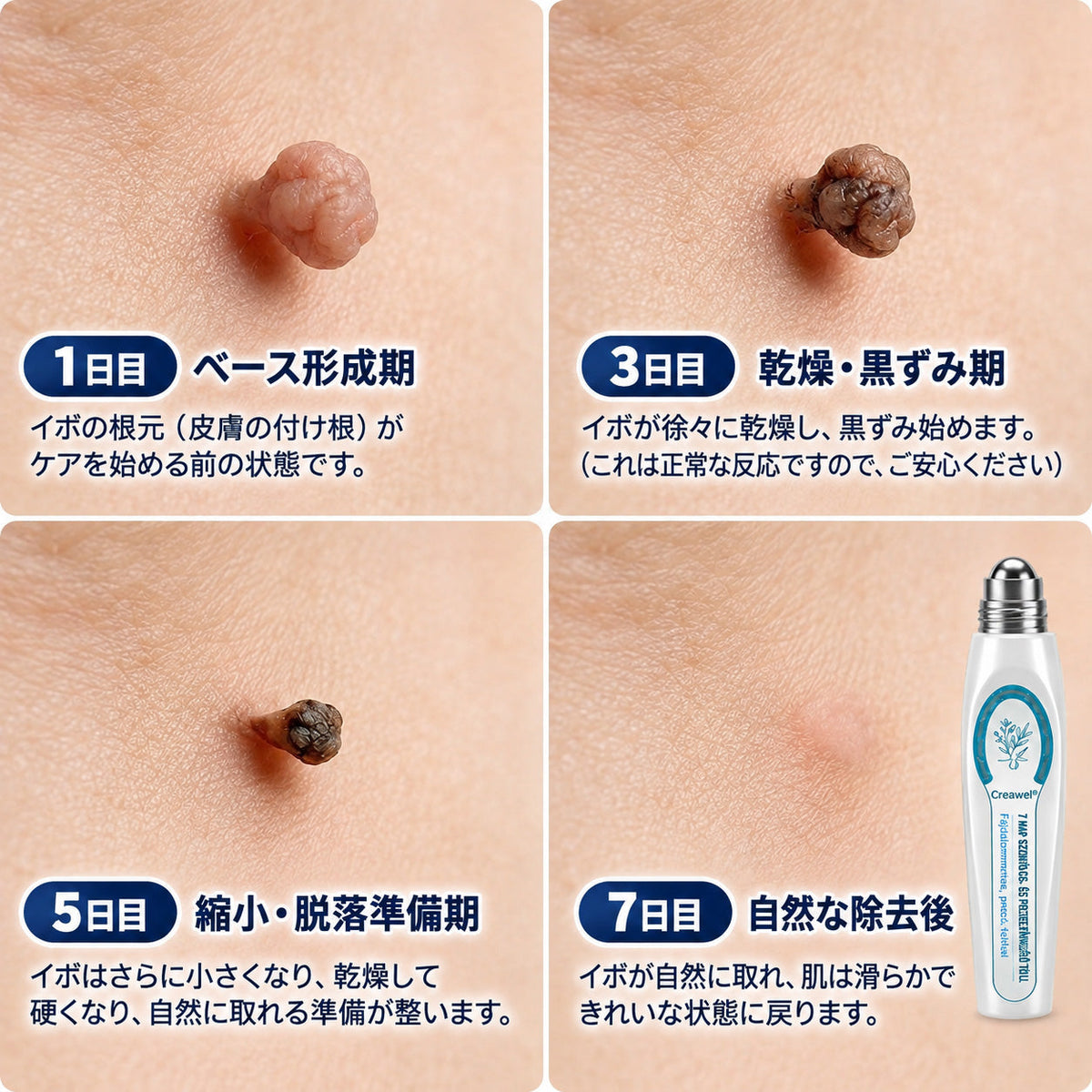 🇯🇵 👨‍⚕️🖋️Creawel® 公式ストア｜7日間集中ケア｜首元・デコルテの気になるポツポツを毎日ピンポイントケア🖋️🌕🍃