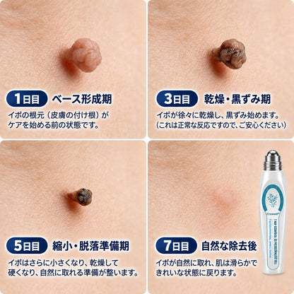 🇯🇵 👨‍⚕️🖋️Creawel® 公式ストア｜7日間集中ケア｜首元・デコルテの気になるポツポツを毎日ピンポイントケア🖋️🌕🍃