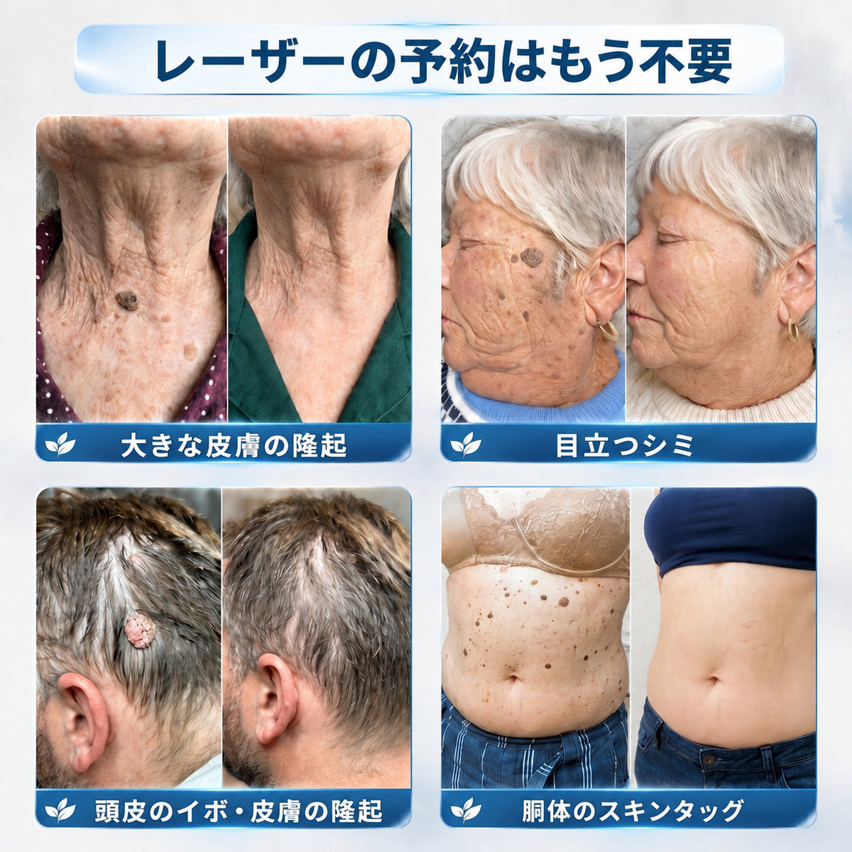 🇯🇵 👨‍⚕️🖋️Creawel® 公式ストア｜7日間集中ケア｜首元・デコルテの気になるポツポツを毎日ピンポイントケア🖋️🌕🍃