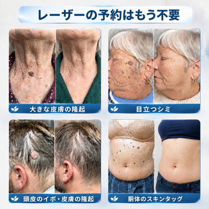 🇯🇵 👨‍⚕️🖋️Creawel® 公式ストア｜7日間集中ケア｜首元・デコルテの気になるポツポツを毎日ピンポイントケア🖋️🌕🍃