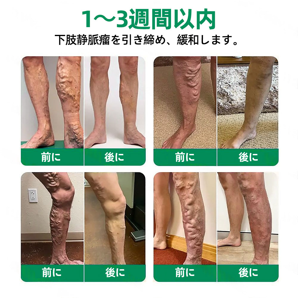𝐉𝐏👨‍⚕️👍✅𝐇𝐞𝐚𝐥𝐫𝐢𝐳𝐞® 𝐕𝐞𝐢𝐧𝐓𝐚𝐫𝐠𝐞𝐭 マイクロニードルパッチ ⚡即時の快適さ、長期的な結果⏰