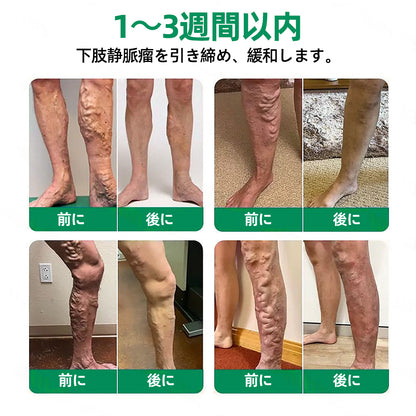 𝐉𝐏👨‍⚕️👍✅𝐇𝐞𝐚𝐥𝐫𝐢𝐳𝐞® 𝐕𝐞𝐢𝐧𝐓𝐚𝐫𝐠𝐞𝐭 マイクロニードルパッチ ⚡即時の快適さ、長期的な結果⏰