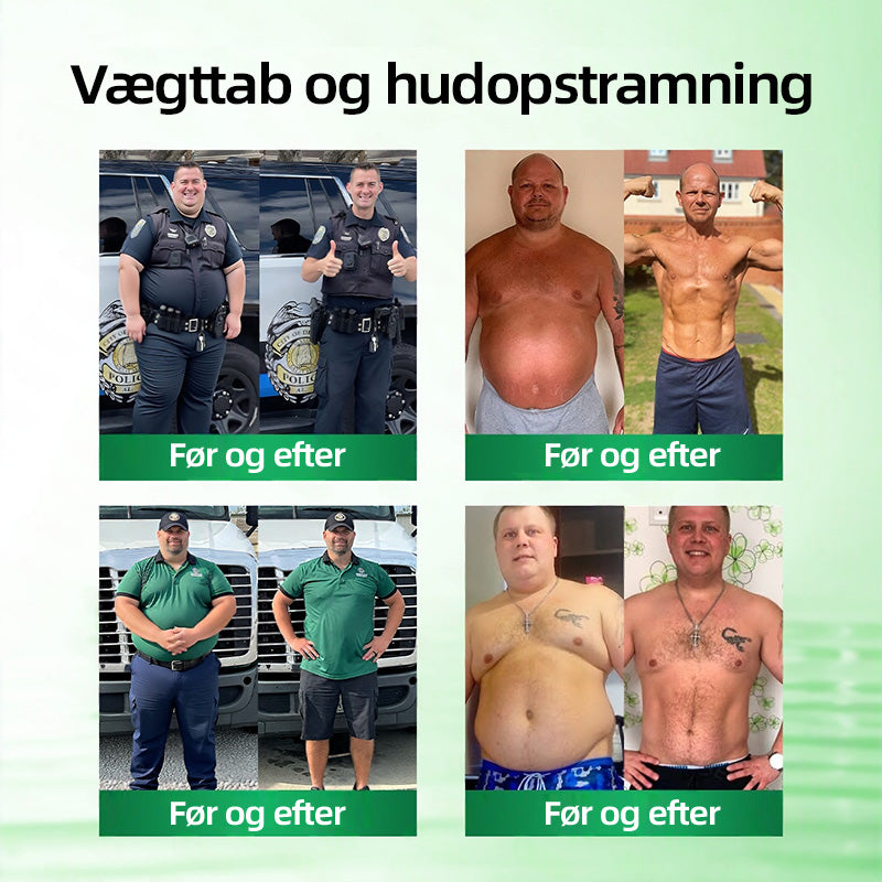 Officiel Butik | 🧡🧡CureVivo® Moringa · Berberin × NAD+ 10-i-1 Avanceret Nano Mikronålplaster 🇩🇰 (Én gang om dagen, synlige resultater på 7 dage) ✅ Til overvægt, slap hud, diabetes, søvnapnø, ledproblemer med mere