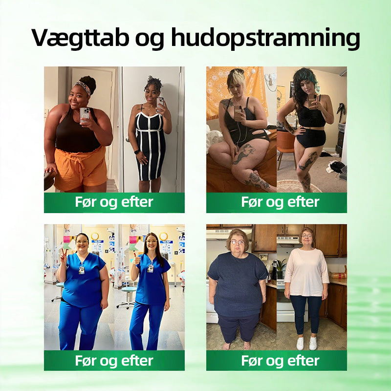 Officiel Butik | 🧡🧡CureVivo® Moringa · Berberin × NAD+ 10-i-1 Avanceret Nano Mikronålplaster 🇩🇰 (Én gang om dagen, synlige resultater på 7 dage) ✅ Til overvægt, slap hud, diabetes, søvnapnø, ledproblemer med mere