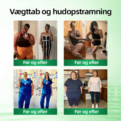 Officiel Butik | 🧡🧡CureVivo® Moringa · Berberin × NAD+ 10-i-1 Avanceret Nano Mikronålplaster 🇩🇰 (Én gang om dagen, synlige resultater på 7 dage) ✅ Til overvægt, slap hud, diabetes, søvnapnø, ledproblemer med mere