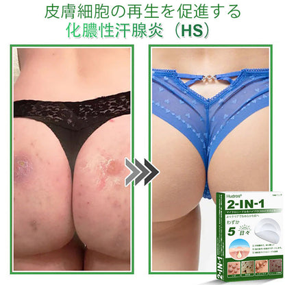 𝐇𝐮𝐝𝐫𝐨𝐬® 📌 𝟐-𝐢𝐧-𝟏 ハイドロコロイドマイクロニードルパッチ｜盛り上がったほくろ、ニキビ、平らなイボおよび皮膚の突起の除去用に特別設計｜𝟏𝟒𝟒枚入りパッケージ🌱🌱