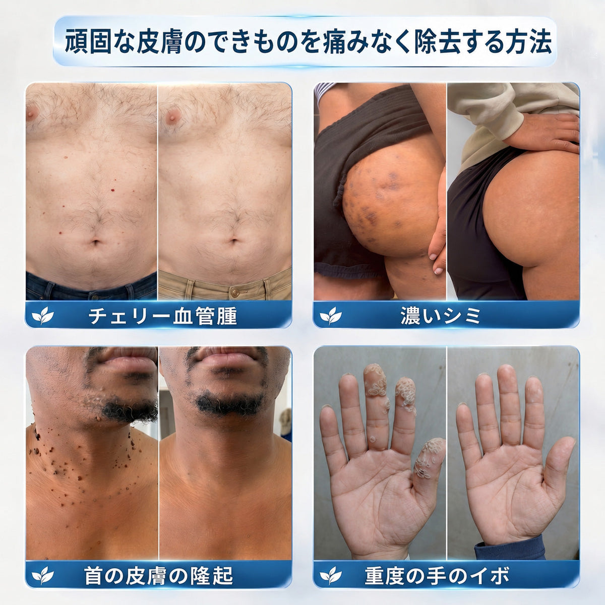 🇯🇵 👨‍⚕️🖋️Creawel® 公式ストア｜7日間集中ケア｜首元・デコルテの気になるポツポツを毎日ピンポイントケア🖋️🌕🍃