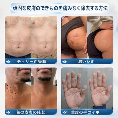 🇯🇵 👨‍⚕️🖋️Creawel® 公式ストア｜7日間集中ケア｜首元・デコルテの気になるポツポツを毎日ピンポイントケア🖋️🌕🍃