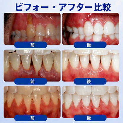 🇯🇵 👨‍⚕️✅🦷 HEATWOLF® GumRevive – 歯周組織修復ジェル 🦷✨2️⃣